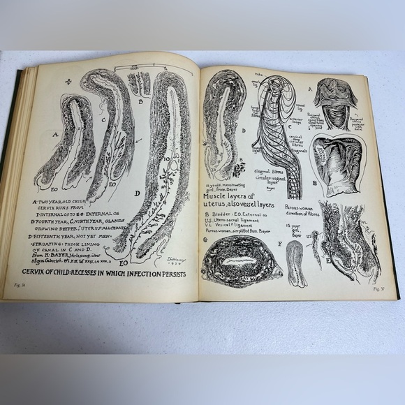 Topographical Hand Atlas Human Sex Anatomy Dickinson 1933 1st Ed Illustrated - Picture 11 of 15